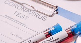 overview-Risk-management-during-the-coronavirus.png